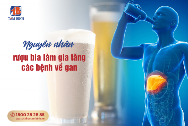 vì sao rượu bia làm gia tăng các bệnh về gan